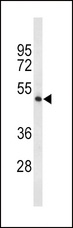 TPH2 Antibody - Western blot of TPH2 Antibody in 293 cell line lysates (35 ug/lane). TPH2 (arrow) was detected using the purified antibody.