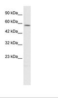 TPH2 Antibody - HepG2 Cell Lysate.  This image was taken for the unconjugated form of this product. Other forms have not been tested.