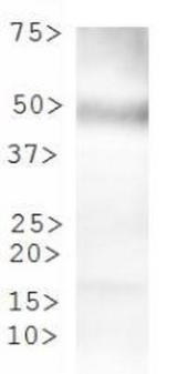 TPH2 Antibody - Western Blot: Tryptophan hydroxylase 2 Antibody - WB analysis of TPH2 in human stomach lysate.  This image was taken for the unconjugated form of this product. Other forms have not been tested.