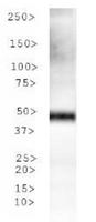 TPH2 Antibody - Western Blot: Tryptophan hydroxylase 2 Antibody - WB analysis of TPHZ in human stomach lysate.  This image was taken for the unconjugated form of this product. Other forms have not been tested.