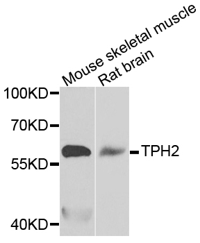 TPH2 Antibody - Western blot analysis of extracts of various tissues.