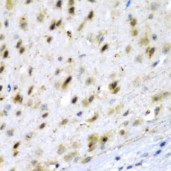 TPH2 Antibody - Immunohistochemistry of paraffin-embedded mouse brain tissue.