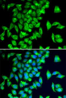 TPH2 Antibody - Immunofluorescence analysis of A549 cells.