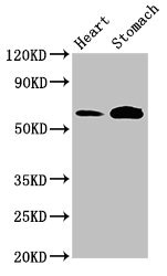 TPH2 Antibody - Western Blot Positive WB detected in: Rat heart tissue, Mouse stomach tissue All lanes: TPH2 antibody at 3µg/ml Secondary Goat polyclonal to rabbit IgG at 1/50000 dilution Predicted band size: 57 kDa Observed band size: 57 kDa