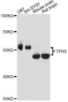 TPH2 Antibody - Western blot analysis of extracts of various cell lines, using TPH2 antibody at 1:3000 dilution. The secondary antibody used was an HRP Goat Anti-Rabbit IgG (H+L) at 1:10000 dilution. Lysates were loaded 25ug per lane and 3% nonfat dry milk in TBST was used for blocking. An ECL Kit was used for detection and the exposure time was 30s.