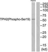 TPH2 Antibody - Western blot analysis of extracts from HepG2 cells, using TPH2 (Phospho-Ser19) antibody.