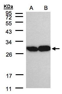 TPI1 / TPI Antibody - Sample (30 ug of whole cell lysate). A: A431, B: H1299. 12% SDS PAGE. TPI1 antibody diluted at 1:2000