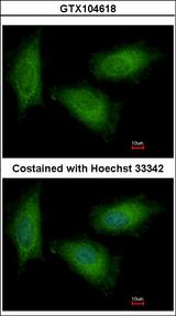 TPI1 / TPI Antibody - Immunofluorescence of paraformaldehyde-fixed HeLa using Triosephosphate isomerase antibody at 1:500 dilution.