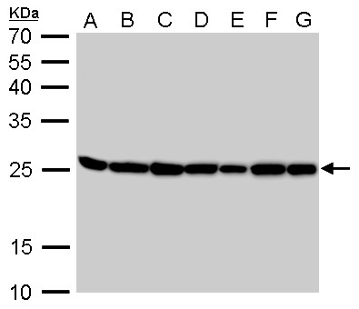 TPI1 / TPI Antibody - Triosephosphate isomerase antibody [C2C3], C-term detects TPI1 protein by Western blot analysis. A. 30 ug Neuro2A whole cell lysate/extract. B. 30 ug GL261 whole cell lysate/extract. C. 30 ug C8D30 whole cell lysate/extract. D. 30 ug NIH-3T3 whole cell lysate/extract. E. 30 ug BCL-1 whole cell lysate/extract. F. 30 ug Raw264.7 whole cell lysate/extract. G. 30 ug C2C12 whole cell lysate/extract. 12 % SDS-PAGE. Triosephosphate isomerase antibody [C2C3], C-term dilution:1:1000