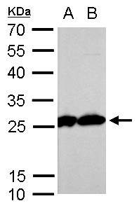 TPI1 / TPI Antibody - Triosephosphate isomerase antibody [C2C3], C-term detects TPI1 protein by Western blot analysis. A. 30 ug PC-12 whole cell lysate/extract. B. 30 ug Rat2 whole cell lysate/extract. 12 % SDS-PAGE. Triosephosphate isomerase antibody [C2C3], C-term dilution:1:1000