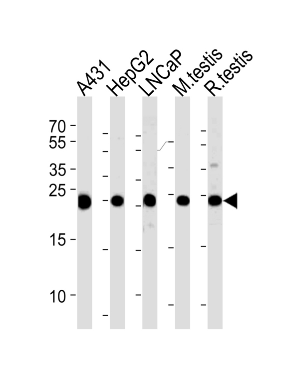 TPI1 / TPI Antibody - Western blot of lysates from A431, HepG2, LNCaP cell line and mouse testis, rat testis tissue lysates (from left to right), using TPI1 Antibody. Antibody was diluted at 1:1000 at each lane.A goat anti-rabbit IgG H&L (HRP) at 1:5000 dilution was used as the secondary antibody. Lysate at 35ug per lane.