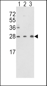 TPI1 / TPI Antibody - Western blot of TPI1 Antibody in Y79(lane 1),CEM(lane 2) cell line and mouse brain tissue(lane 3) lysates (35 ug/lane). TPI1 (arrow) was detected using the purified antibody.(2 ug/ml)