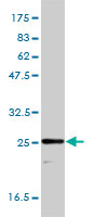 TPI1 / TPI Antibody - TPI1 monoclonal antibody (M01), clone 1D10-2E2 Western Blot analysis of TPI1 expression in HepG2.