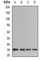 TPI1 / TPI Antibody - Western blot analysis of TIM expression in Jurkat (A); HepG2 (B); mouse kidney (C); mouse brain (D) whole cell lysates.