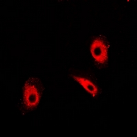 TPI1 / TPI Antibody - Immunofluorescent analysis of TIM staining in HeLa cells. Formalin-fixed cells were permeabilized with 0.1% Triton X-100 in TBS for 5-10 minutes and blocked with 3% BSA-PBS for 30 minutes at room temperature. Cells were probed with the primary antibody in 3% BSA-PBS and incubated overnight at 4 deg C in a humidified chamber. Cells were washed with PBST and incubated with a DyLight 594-conjugated secondary antibody (red) in PBS at room temperature in the dark.