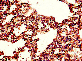 TPI1 / TPI Antibody - Immunohistochemistry of paraffin-embedded human lung tissue using TPI1 Antibody at dilution of 1:100