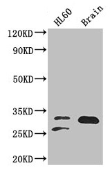 TPI1 / TPI Antibody - Western Blot Positive WB detected in: HL60 whole cell lysate, Mouse brain tissue All lanes: TPI1 antibody at 2µg/ml Secondary Goat polyclonal to rabbit IgG at 1/50000 dilution Predicted band size: 31, 27, 18 kDa Observed band size: 31, 27 kDa