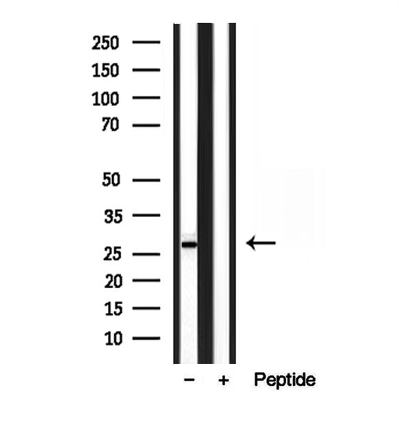 TPI1 / TPI Antibody - Western blot analysis of extracts of HepG2 cells using TPI1 antibody.