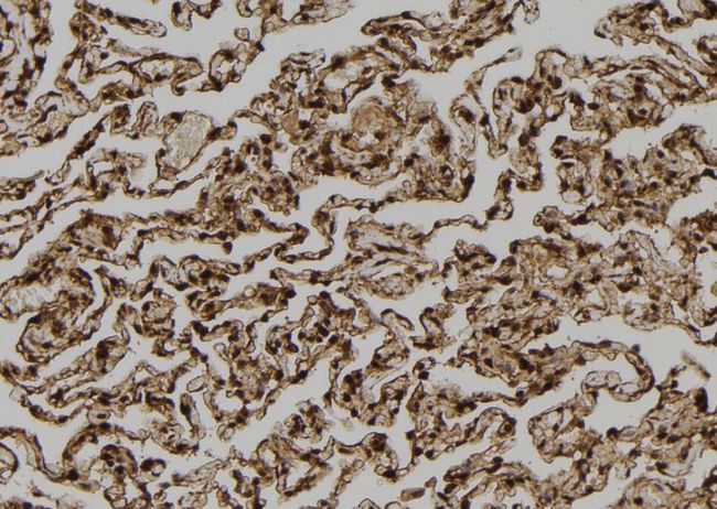 TPI1 / TPI Antibody - 1:100 staining human lung tissue by IHC-P. The sample was formaldehyde fixed and a heat mediated antigen retrieval step in citrate buffer was performed. The sample was then blocked and incubated with the antibody for 1.5 hours at 22°C. An HRP conjugated goat anti-rabbit antibody was used as the secondary.