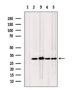 TPI1 / TPI Antibody - Western blot analysis of extracts of various samples using TPI1 antibody. Lane 1: rat heart treated with blocking peptide. Lane 2: rat heart; Lane 3: mouse brain; Lane 4: HeLa; Lane 5: HepG2;