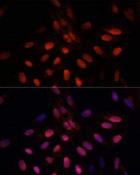 TPI1 / TPI Antibody - Immunofluorescence analysis of U-2OS cells using TPI1 Polyclonal Antibody at dilution of 1:100.Blue: DAPI for nuclear staining.