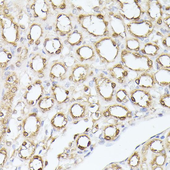 TPI1 / TPI Antibody - Immunohistochemistry of paraffin-embedded Mouse kidney using TPI1 Polyclonal Antibody at dilution of 1:100 (40x lens).