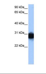 TPI1 / TPI Antibody - HepG2 cell lysate. Antibody concentration: 1.0 ug/ml. Gel concentration: 12%.  This image was taken for the unconjugated form of this product. Other forms have not been tested.