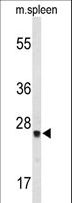 TPK1 Antibody - Western blot of TPK1 Antibody in mouse spleen tissue lysates (35 ug/lane). TPK1 (arrow) was detected using the purified antibody.