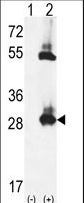 TPK1 Antibody - Western blot of TPK1 (arrow) using rabbit polyclonal TPK1 Antibody. 293 cell lysates (2 ug/lane) either nontransfected (Lane 1) or transiently transfected (Lane 2) with the TPK1 gene.
