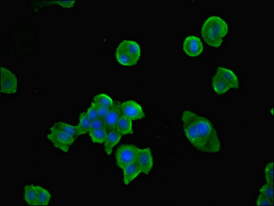 TPK1 Antibody - Immunofluorescent analysis of PC3 cells diluted at 1:100 and Alexa Fluor 488-congugated AffiniPure Goat Anti-Rabbit IgG(H+L)