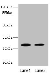 TPK1 Antibody - Western blot All Lanes: TPK1 antibody at 0.78ug/ml Lane 1: Mouse liver tissue Lane 2: Mouse kidney tissue Secondary Goat polyclonal to rabbit IgG at 1/10000 dilution Predicted band size: 28,14 kDa Observed band size: 27 kDa