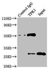 TPK1 Antibody