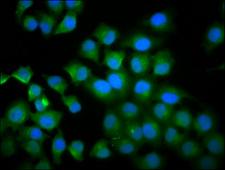 TPK1 Antibody - Immunofluorescence staining of A549 cells diluted at 1:100, counter-stained with DAPI. The cells were fixed in 4% formaldehyde, permeabilized using 0.2% Triton X-100 and blocked in 10% normal Goat Serum. The cells were then incubated with the antibody overnight at 4°C.The Secondary antibody was Alexa Fluor 488-congugated AffiniPure Goat Anti-Rabbit IgG (H+L).