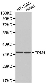 TPM1 / Tropomyosin Antibody - Western blot of TPM1 pAb in extracts from HT-1080 cells and mouse heart tissue.