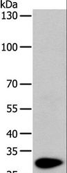 TPM1 / Tropomyosin Antibody - Western blot analysis of Mouse heart tissue, using TPM1 Polyclonal Antibody at dilution of 1:1000.