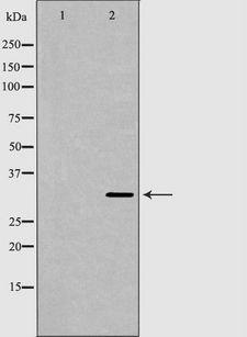 TPM1 / Tropomyosin Antibody - Western blot analysis of HepG2 whole cells lysates using TPM1 antibody. The lane on the left is treated with the antigen-specific peptide.