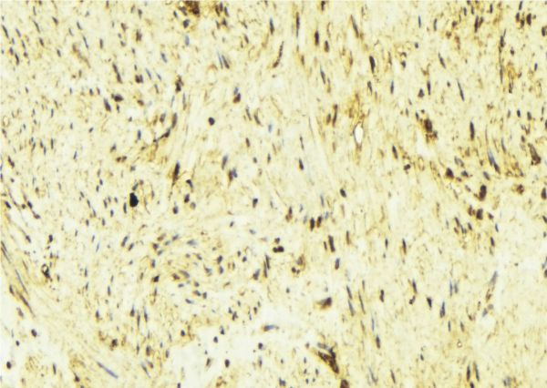 TPM1 / Tropomyosin Antibody - 1:100 staining mouse muscle tissue by IHC-P. The sample was formaldehyde fixed and a heat mediated antigen retrieval step in citrate buffer was performed. The sample was then blocked and incubated with the antibody for 1.5 hours at 22°C. An HRP conjugated goat anti-rabbit antibody was used as the secondary.