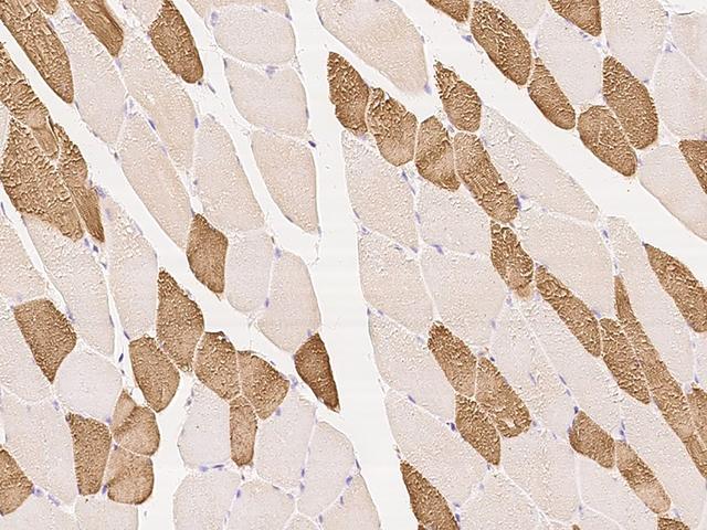 TPM1 / Tropomyosin Antibody - Immunochemical staining of human TPM1 in human skeletal muscle with rabbit polyclonal antibody at 1:100 dilution, formalin-fixed paraffin embedded sections.