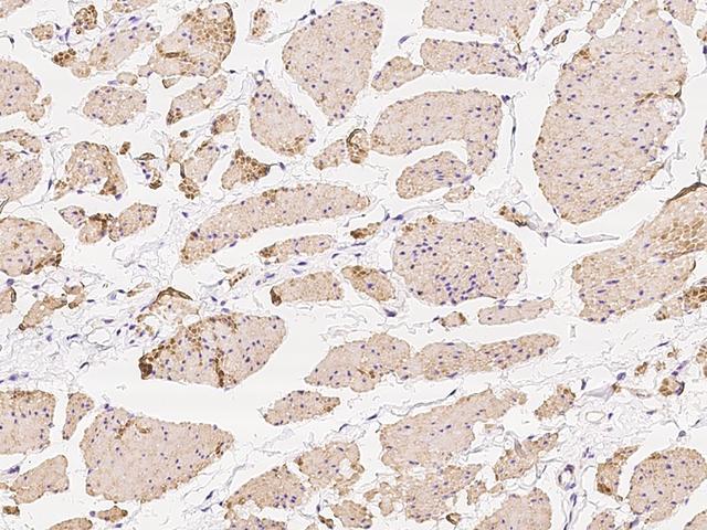 TPM1 / Tropomyosin Antibody - Immunochemical staining of human TPM1 in human smooth muscle with rabbit polyclonal antibody at 1:100 dilution, formalin-fixed paraffin embedded sections.
