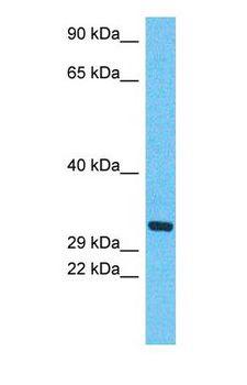 TPM1 / Tropomyosin Antibody - Western blot of TPM1 Antibody with human 721_B Whole Cell lysate.  This image was taken for the unconjugated form of this product. Other forms have not been tested.