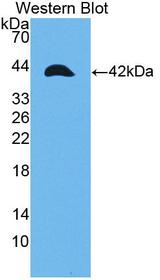 TPM2 Antibody - Western blot of TPM2 antibody.