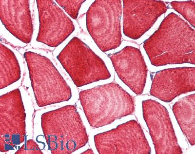 TPM2 Antibody - Human Skeletal Muscle: Formalin-Fixed, Paraffin-Embedded (FFPE)