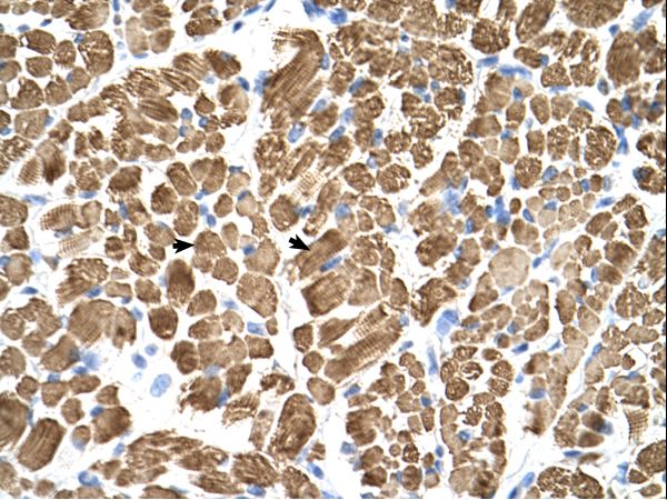 TPM2 Antibody - TPM2 antibody TPM2(tropomyosin 2 (beta)) Antibody was used in IHC to stain formalin-fixed, paraffin-embedded human muscle.  This image was taken for the unconjugated form of this product. Other forms have not been tested.