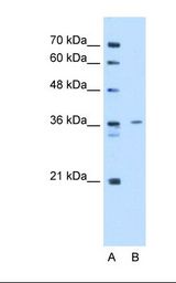 TPM2 Antibody - Lane A: Marker. Lane B: HepG2 cell lysate. Antibody concentration: 2.5 ug/ml. Gel concentration: 12%.  This image was taken for the unconjugated form of this product. Other forms have not been tested.