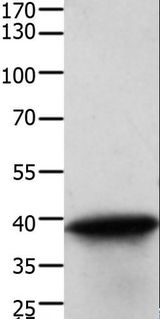 TPM2 Antibody - Western blot analysis of Human cervical cancer tissue, using TPM2 Polyclonal Antibody at dilution of 1:600.