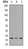 TPM2 Antibody - Western blot analysis of Tropomyosin 2 expression in HeLa (A); MCF7 (B); mouse lung (C) whole cell lysates.