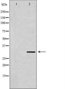 TPM2 Antibody - Western blot analysis of HeLa cell lysates using TPM2 antibody. The lane on the left is treated with the antigen-specific peptide.