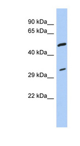 TPM3 Antibody - TPM3 antibody Western blot of THP-1 cell lysate. This image was taken for the unconjugated form of this product. Other forms have not been tested.