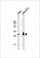 TPM3 Antibody - All lanes: Anti-TPM3 Antibody at 1:2000 dilution Lane 1: Hela whole cell lysate Lane 2: NIH/3T3 whole cell lysate Lysates/proteins at 20 µg per lane. Secondary Goat Anti-mouse IgG, (H+L), Peroxidase conjugated at 1/10000 dilution. Predicted band size: 33 kDa Blocking/Dilution buffer: 5% NFDM/TBST.
