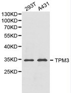 TPM3 Antibody - Western blot of TPM3 pAb in extracts from 293T and A431 cells.